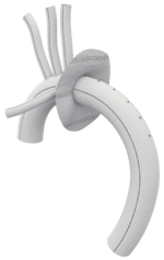 TERUMO AORTIC GELWEAVE product image