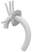 TERUMO AORTIC GELWEAVE product image
