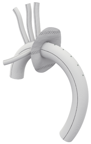 TERUMO AORTIC GELWEAVE product image 1