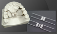 Leone Orthodontics Teleszkópos Hyrax product image