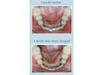 Leone Idea-L Lingual Rendszer product image 2