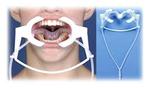 Ortho Technology Nola Dry - Extraoral Cheek Retractors - Lip Ring Retractor product image