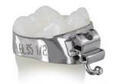 Ortho Technology Fogszabályozó gyűrű product image