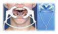Ortho Technology Nola Dry - Extraoral Cheek Retractors - Lip Ring Retractor product image