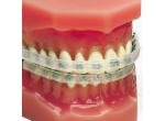 Ortho Technology Fogvédők, viasz, higiéniai táska product image 9
