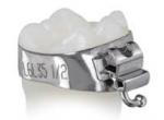 Ortho Technology Fogszabályozó gyűrű product image 1