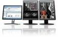 Medimat CARESTREAM HEALTH PACS rendszer product image