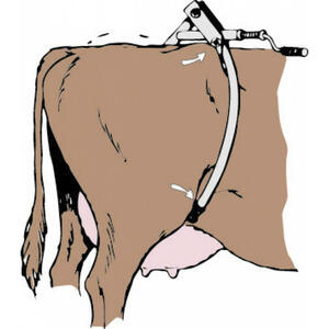 Kétkarú rúgásgátló ajánlatkérés